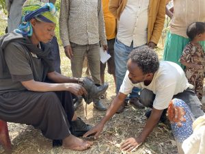 Women with podoconiosis receiving footwear and care